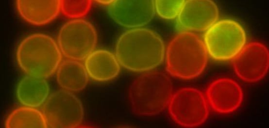 Optical Microscopy Application: Fluorescence